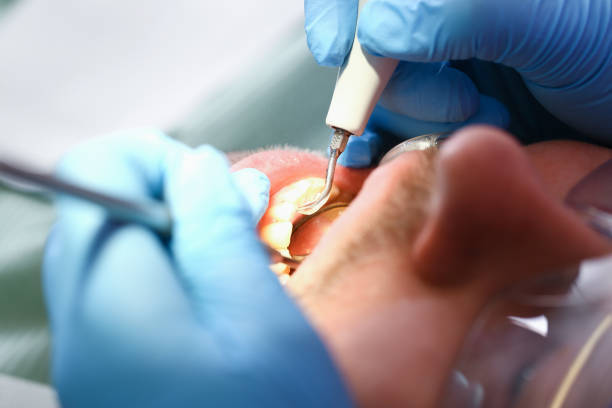 Best Broken or Cracked Tooth Emergency Dentist in Spring Creek, NV