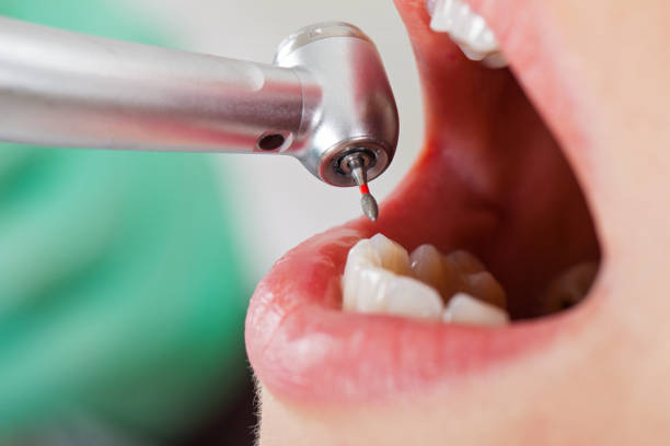 Best Pediatric Emergency Dentist in Spring Creek, NV